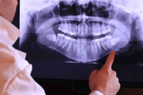 Best Cosmetic Emergency Dentistry in Corydon, IN