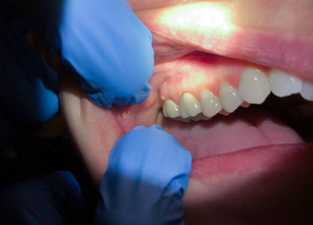Best Emergency TMJ Treatment in Corydon, IN